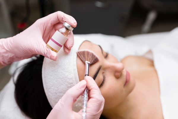 Chemical Peel treatment images